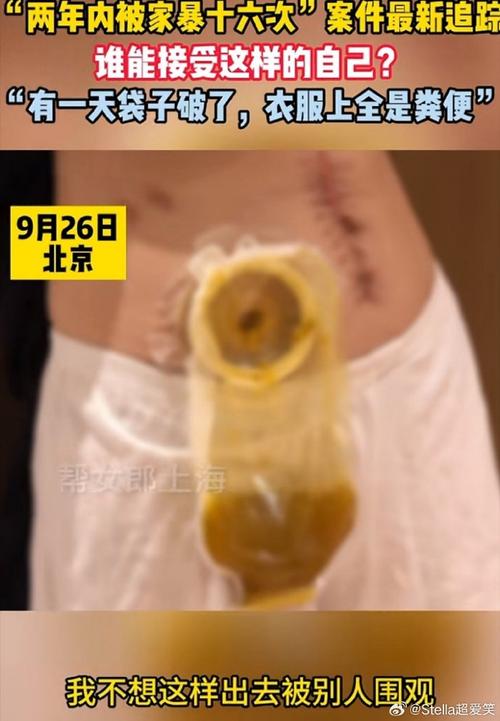 遭家暴16次女子称遭网暴 直播带货被质疑